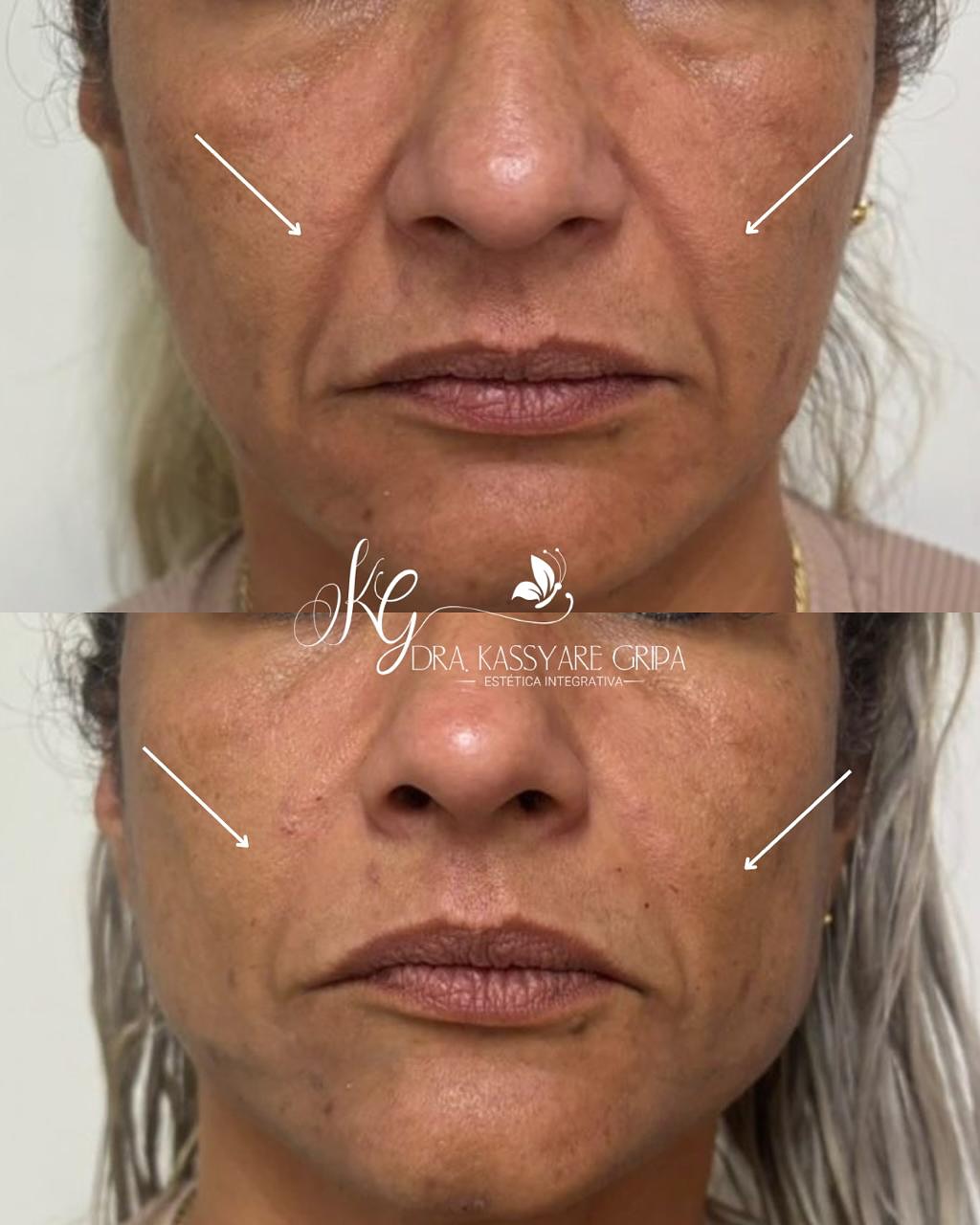 Registro fotográfico de antes e depois 1, fornecido pela clínica