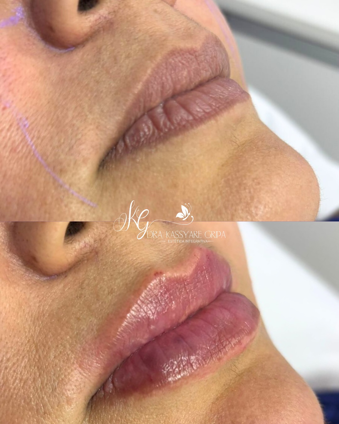 Registro fotográfico de antes e depois 2, fornecido pela clínica
