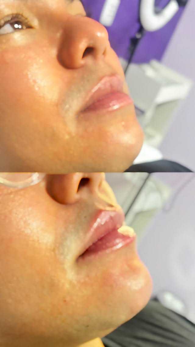 Registro fotográfico de antes e depois 3, fornecido pela clínica