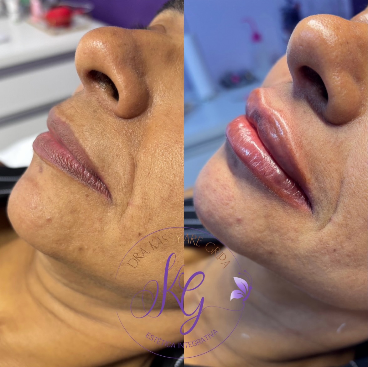 Registro fotográfico de antes e depois 5, fornecido pela clínica