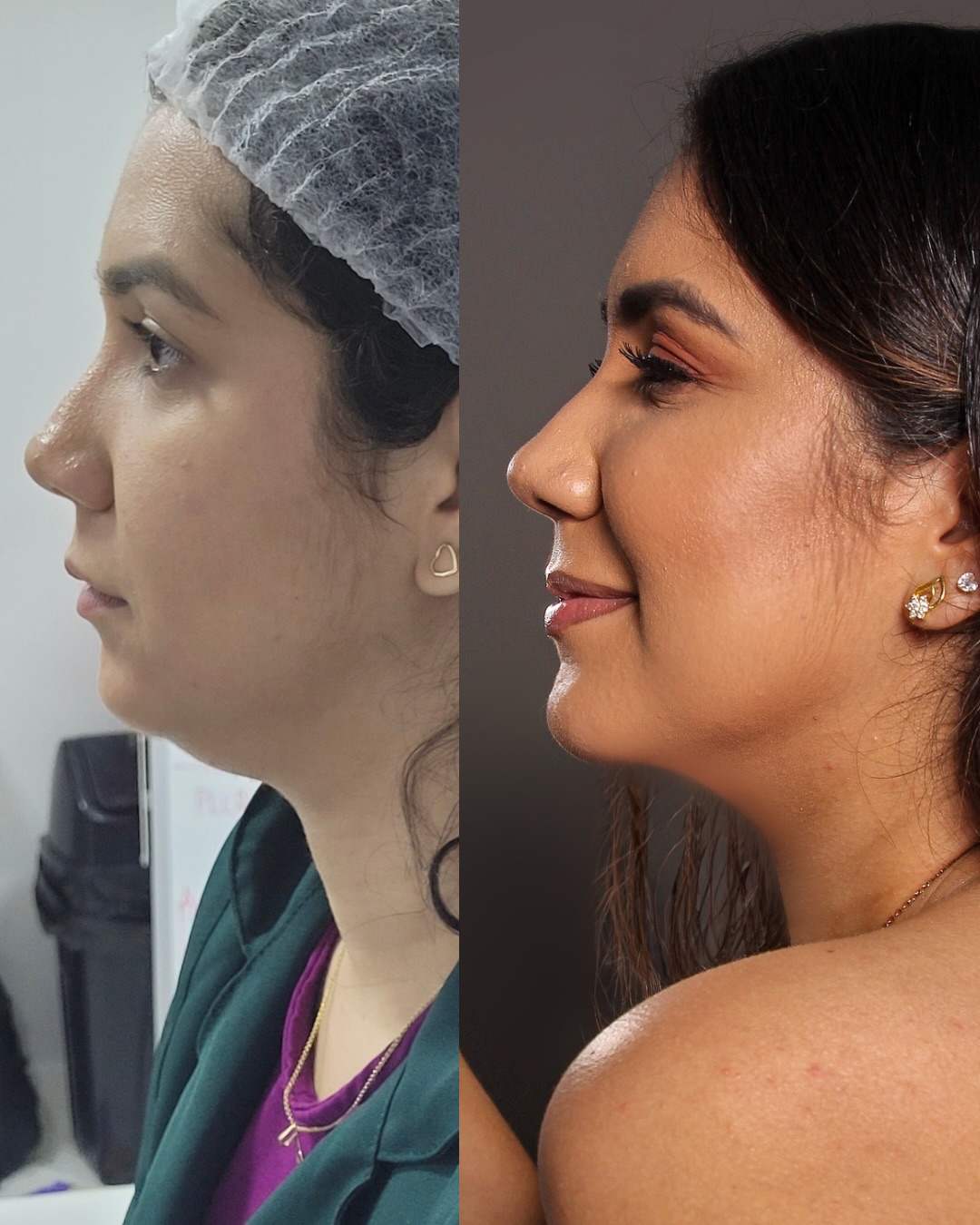 Registro fotográfico de antes e depois 8, fornecido pela clínica